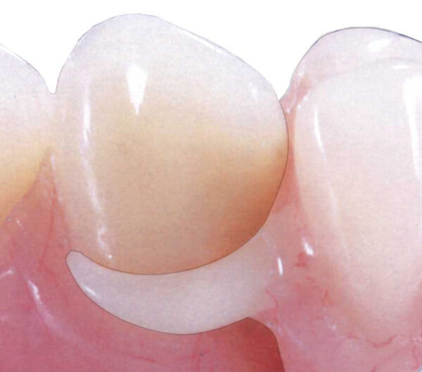 Flexiacetal - Image 2