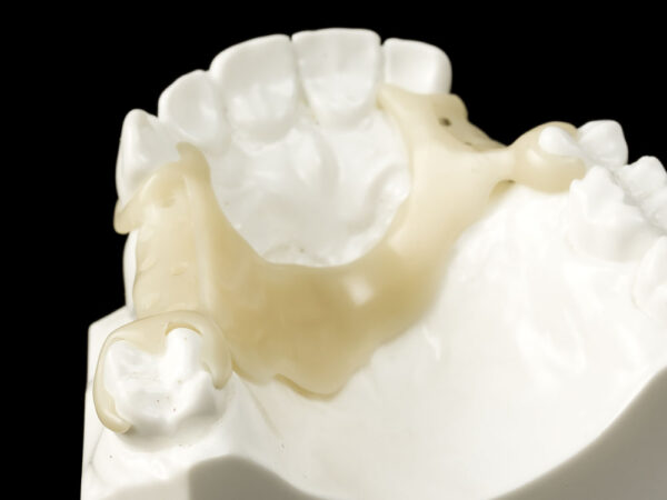 Flexiacetal - Image 3