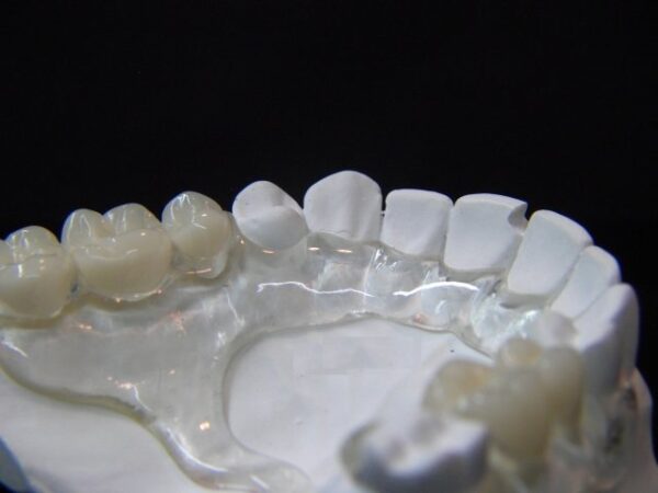 Flexiultra - Image 3