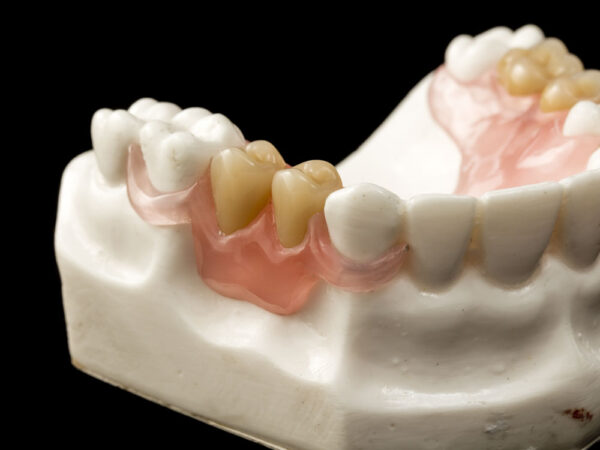 Flexiultra - Image 5