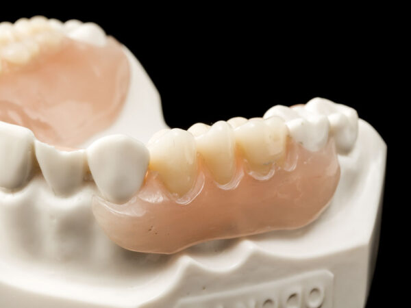 Flexiultra - Image 7