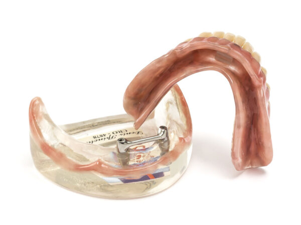 Natural Acryl - Image 5