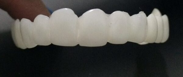 Snap on Smile - Image 2