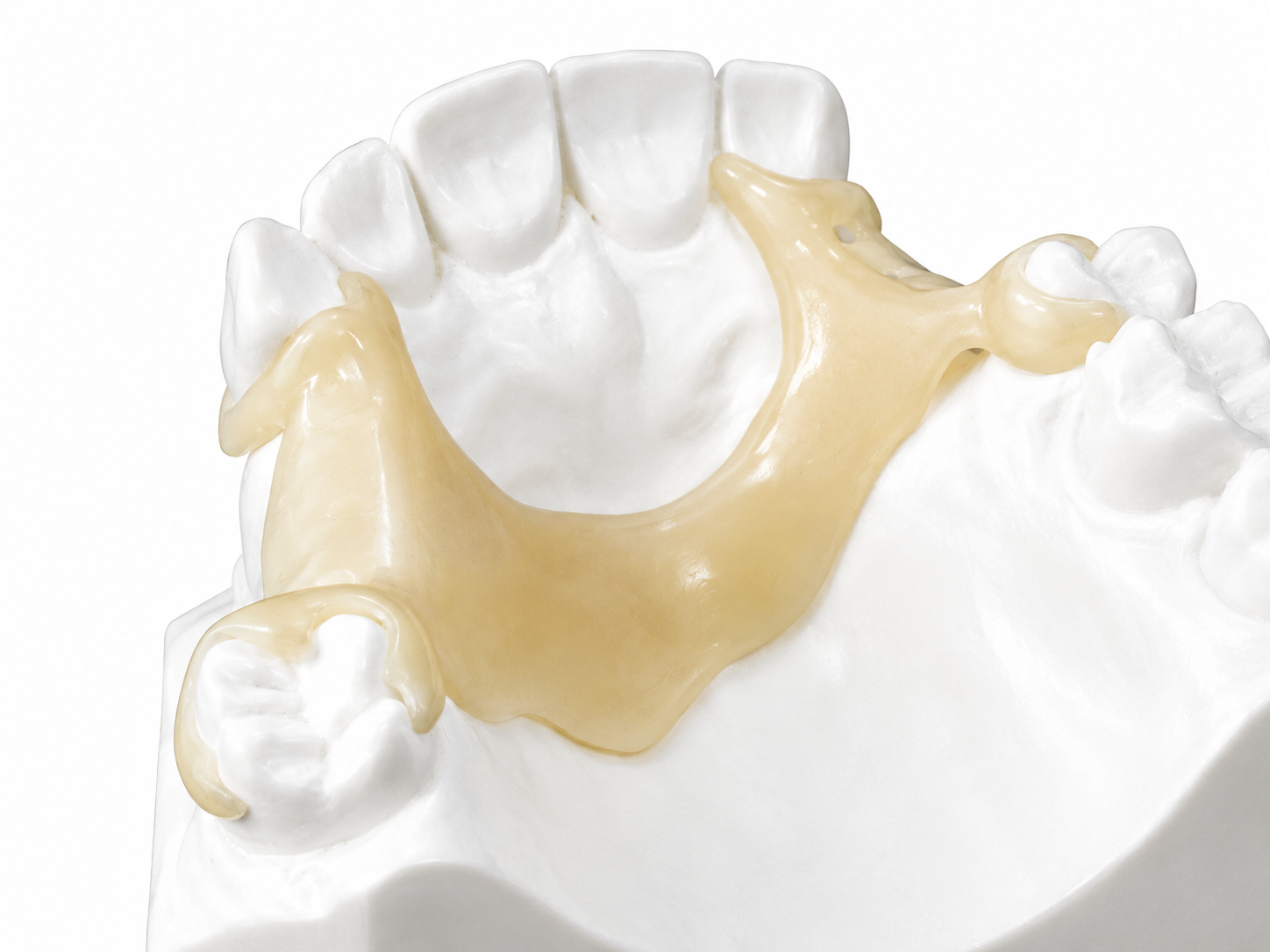 Flexiacetal - Imagen 5